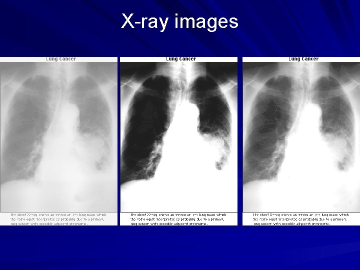 X-ray images 
