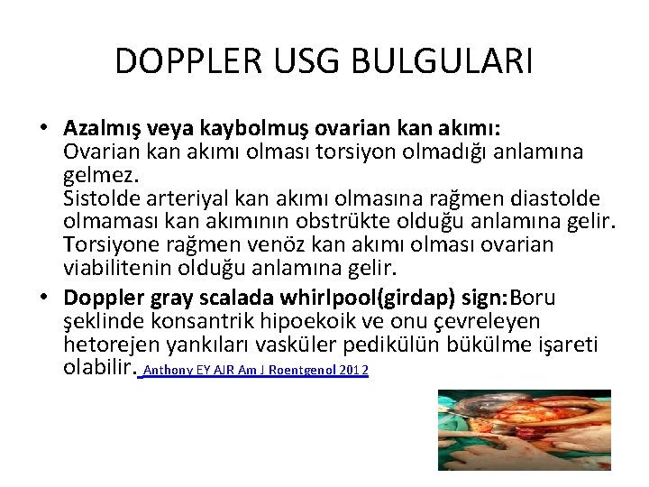 DOPPLER USG BULGULARI • Azalmış veya kaybolmuş ovarian kan akımı: Ovarian kan akımı olması