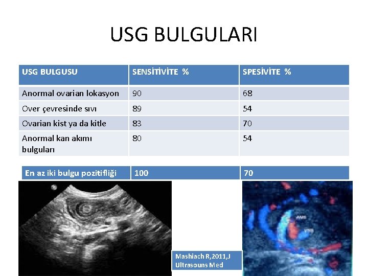 USG BULGULARI USG BULGUSU SENSİTİVİTE % SPESİVİTE % Anormal ovarian lokasyon 90 68 Over