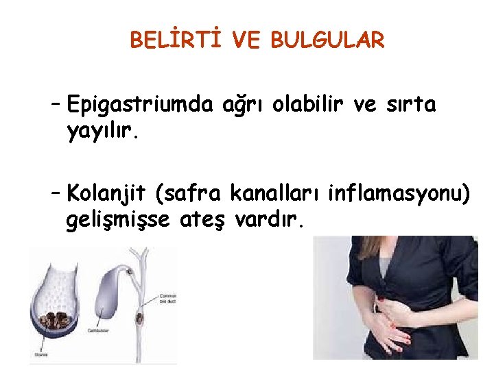 BELİRTİ VE BULGULAR – Epigastriumda ağrı olabilir ve sırta yayılır. – Kolanjit (safra kanalları