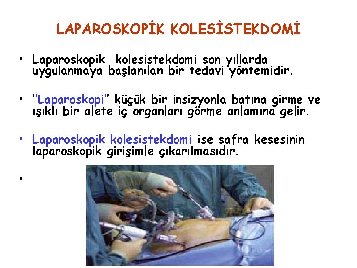 LAPAROSKOPİK KOLESİSTEKDOMİ • Laparoskopik kolesistekdomi son yıllarda uygulanmaya başlanılan bir tedavi yöntemidir. • ‘’Laparoskopi’’