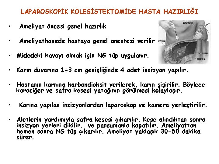 LAPAROSKOPİK KOLESİSTEKTOMİDE HASTA HAZIRLIĞI • Ameliyat öncesi genel hazırlık • Ameliyathanede hastaya genel anestezi