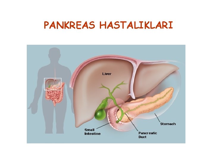 PANKREAS HASTALIKLARI 