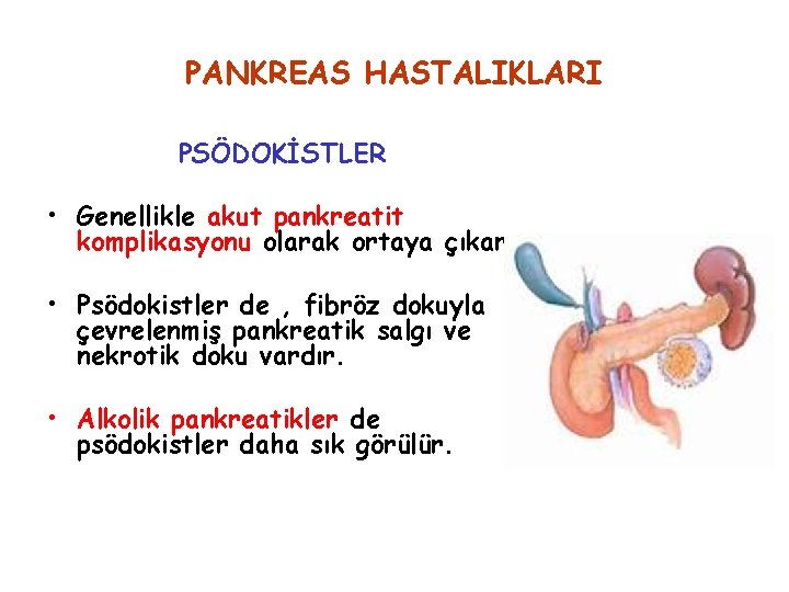 PANKREAS HASTALIKLARI PSÖDOKİSTLER • Genellikle akut pankreatit komplikasyonu olarak ortaya çıkar. • Psödokistler de