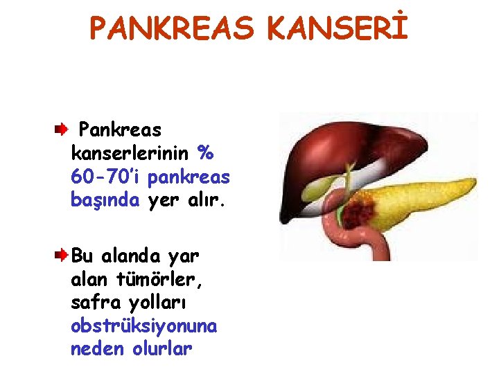 PANKREAS KANSERİ Pankreas kanserlerinin % 60 -70’i pankreas başında yer alır. Bu alanda yar