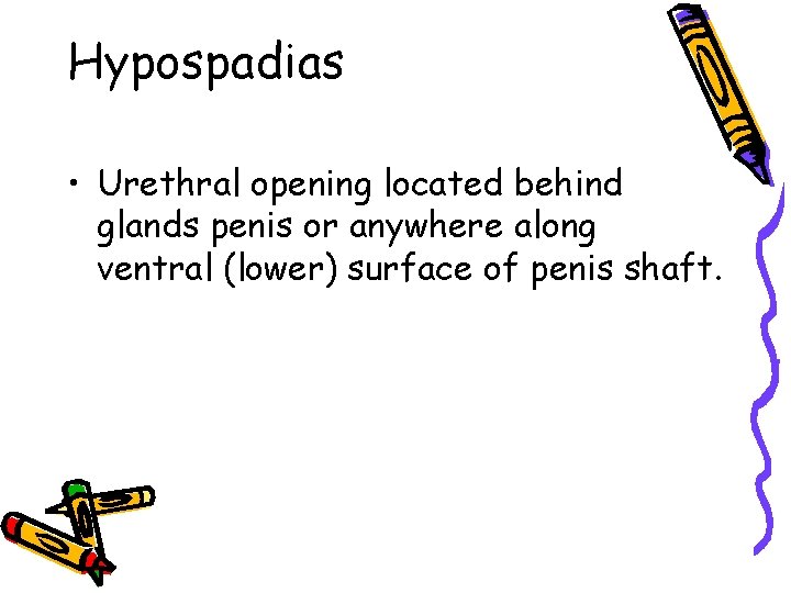 Hypospadias • Urethral opening located behind glands penis or anywhere along ventral (lower) surface Hypospadias • Urethral opening located behind glands penis or anywhere along ventral (lower) surface