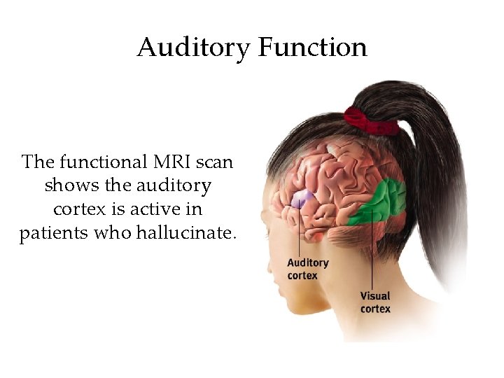 Auditory Function The functional MRI scan shows the auditory cortex is active in patients
