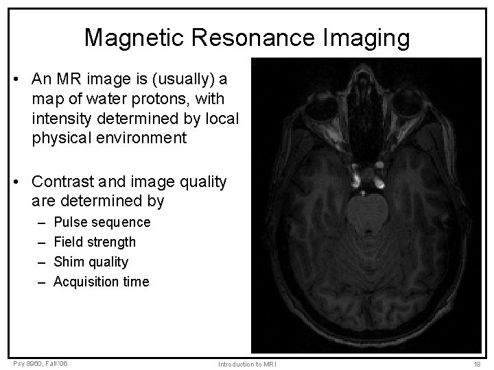 Magnetic Resonance Imaging • An MR image is (usually) a map of water protons,