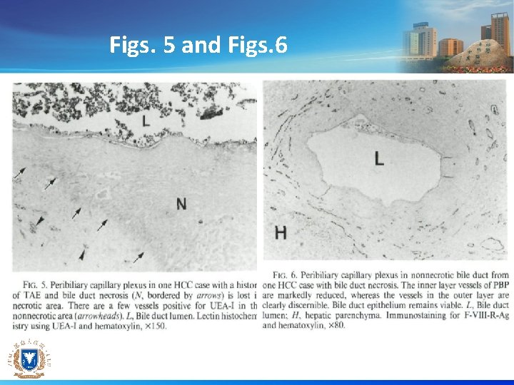 Figs. 5 and Figs. 6 