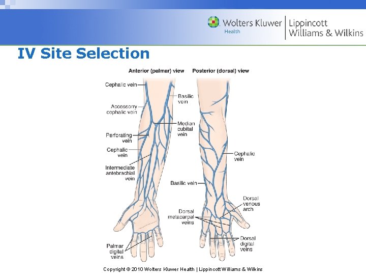IV Site Selection Copyright © 2010 Wolters Kluwer Health | Lippincott Williams & Wilkins