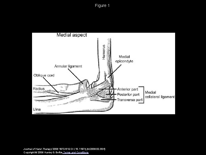 Figure 1 Journal of Hand Therapy 2006 1972 -81 DOI: (10. 1197/j. jht. 2006.