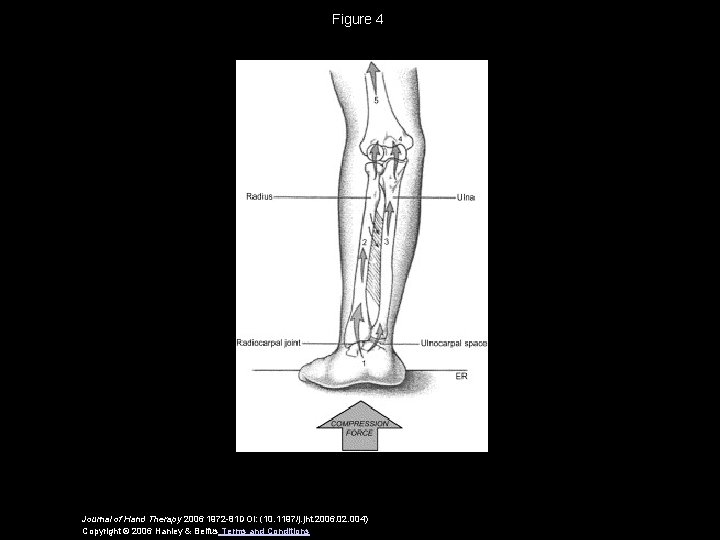 Figure 4 Journal of Hand Therapy 2006 1972 -81 DOI: (10. 1197/j. jht. 2006.