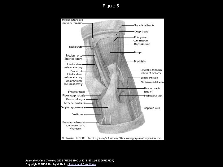 Figure 5 Journal of Hand Therapy 2006 1972 -81 DOI: (10. 1197/j. jht. 2006.