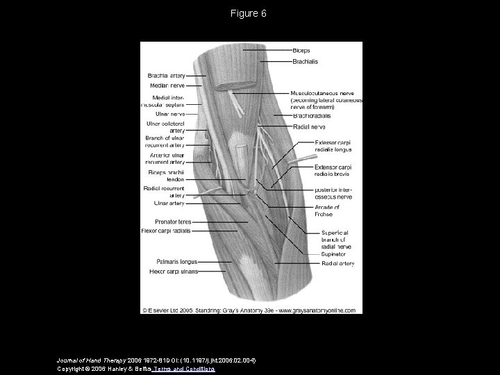 Figure 6 Journal of Hand Therapy 2006 1972 -81 DOI: (10. 1197/j. jht. 2006.