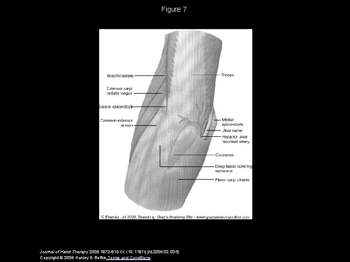 Figure 7 Journal of Hand Therapy 2006 1972 -81 DOI: (10. 1197/j. jht. 2006.