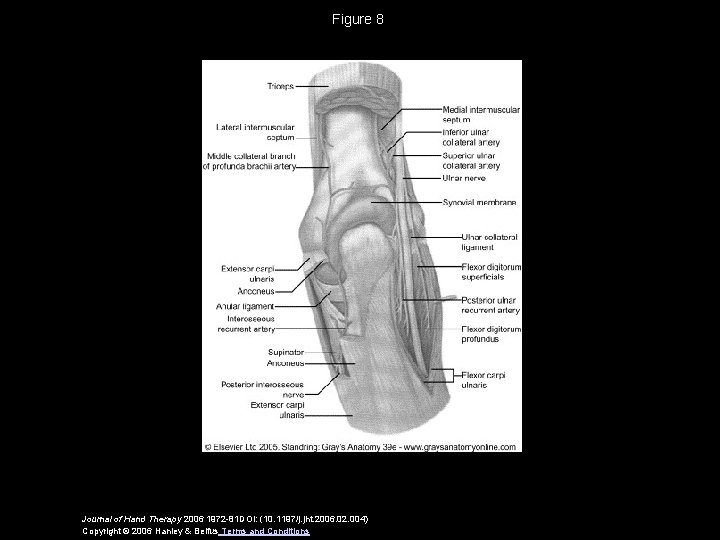 Figure 8 Journal of Hand Therapy 2006 1972 -81 DOI: (10. 1197/j. jht. 2006.
