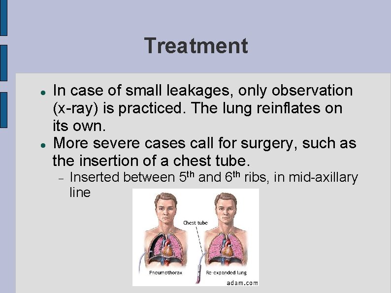 Treatment In case of small leakages, only observation (x-ray) is practiced. The lung reinflates