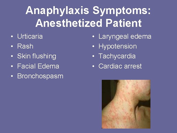 Anaphylaxis Symptoms: Anesthetized Patient • • • Urticaria Rash Skin flushing Facial Edema Bronchospasm