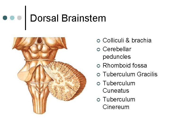 Dorsal Brainstem ¢ ¢ ¢ Colliculi & brachia Cerebellar peduncles Rhomboid fossa Tuberculum Gracilis Dorsal Brainstem ¢ ¢ ¢ Colliculi & brachia Cerebellar peduncles Rhomboid fossa Tuberculum Gracilis