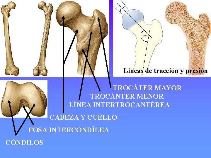 Líneas de tracción y presión TROCÁTER MAYOR TROCÁNTER MENOR LÍNEA INTERTROCANTÉREA CABEZA Y CUELLO