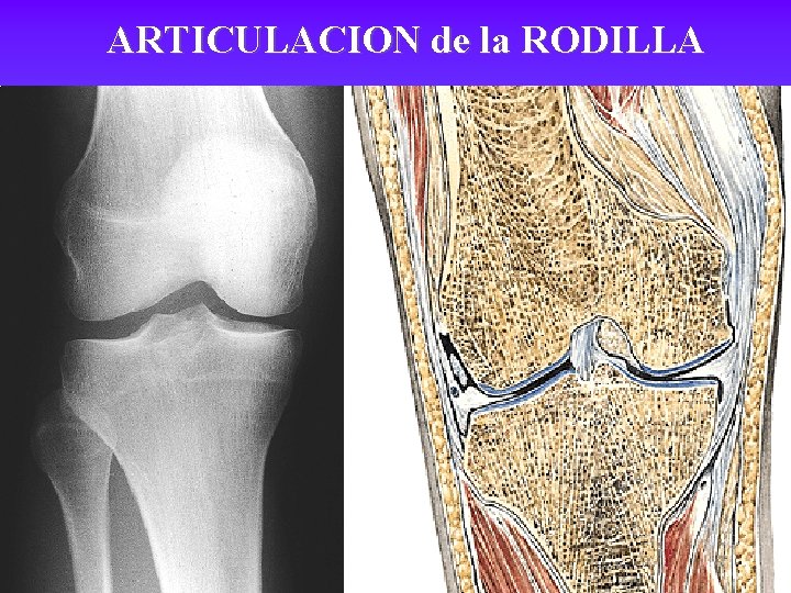 ARTICULACION de la RODILLA 