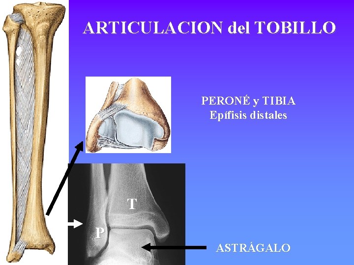 ARTICULACION del TOBILLO PERONÉ y TIBIA Epífisis distales T P ASTRÁGALO 