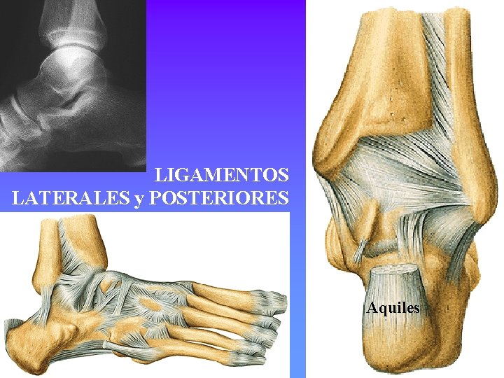 LIGAMENTOS LATERALES y POSTERIORES Aquiles 