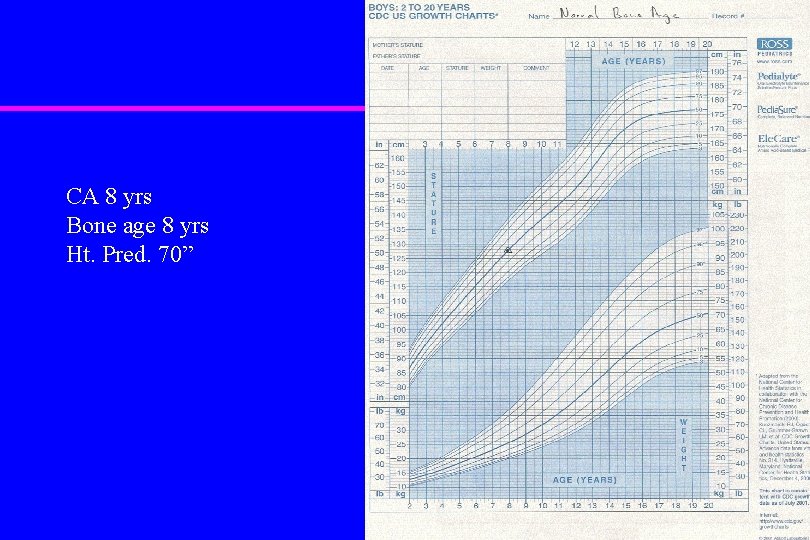 CA 8 yrs Bone age 8 yrs Ht. Pred. 70” 