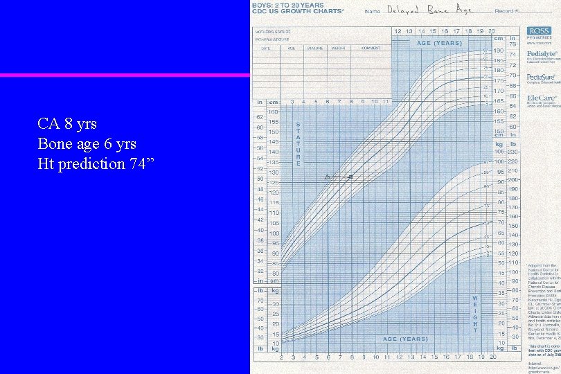 CA 8 yrs Bone age 6 yrs Ht prediction 74” 