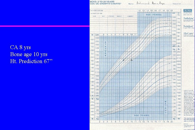 CA 8 yrs Bone age 10 yrs Ht. Prediction 67” 