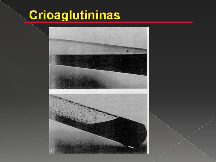 Crioaglutininas 