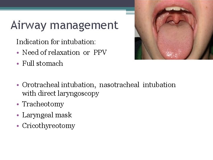 Airway management Indication for intubation: • Need of relaxation or PPV • Full stomach