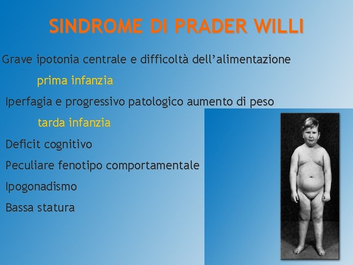 SINDROME DI PRADER WILLI Grave ipotonia centrale e difficoltà dell’alimentazione prima infanzia Iperfagia e