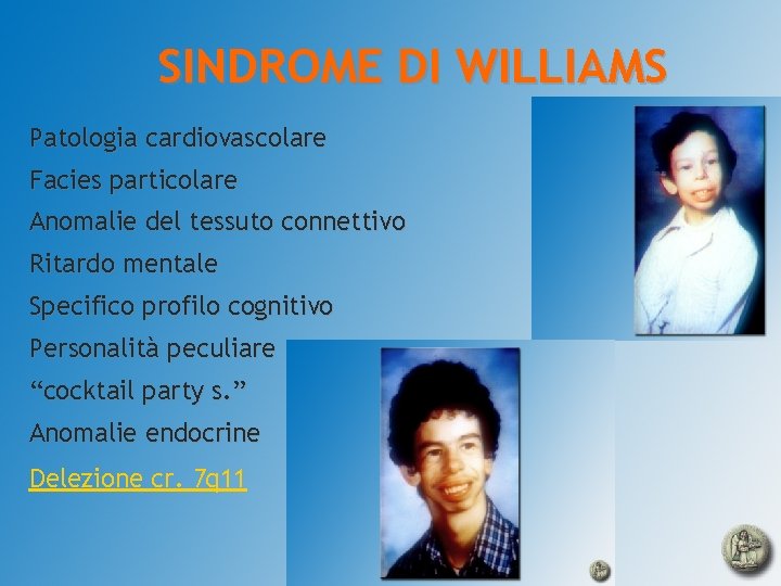 SINDROME DI WILLIAMS Patologia cardiovascolare Facies particolare Anomalie del tessuto connettivo Ritardo mentale Specifico