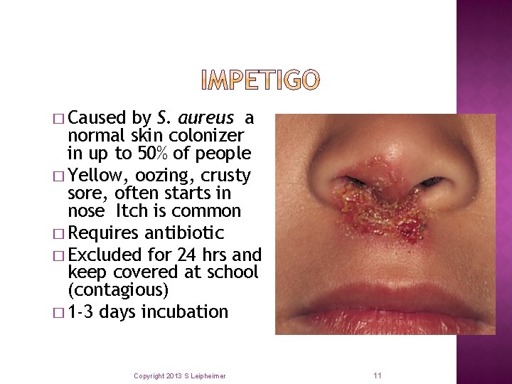 � Caused by S. aureus a normal skin colonizer in up to 50% of