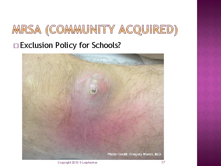 � Exclusion Policy for Schools? Copyright 2013 S Leipheimer 17 