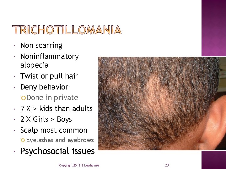  Non scarring Noninflammatory alopecia Twist or pull hair Deny behavior Done in private