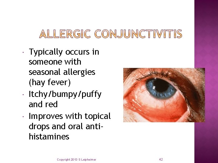  Typically occurs in someone with seasonal allergies (hay fever) Itchy/bumpy/puffy and red Improves