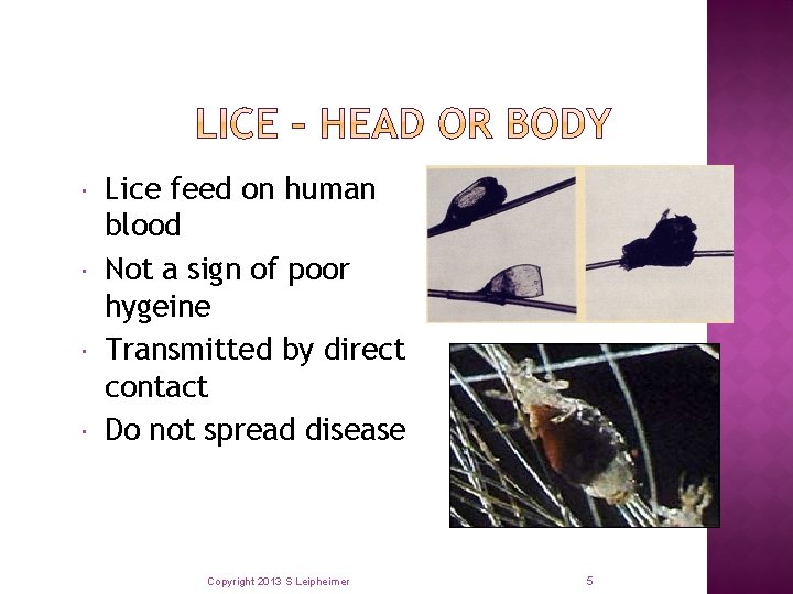  Lice feed on human blood Not a sign of poor hygeine Transmitted by