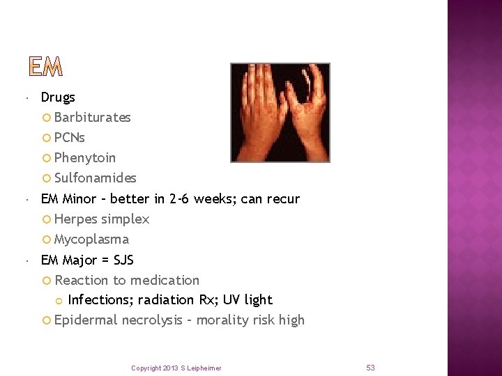  Drugs Barbiturates PCNs Phenytoin Sulfonamides EM Minor – better in 2 -6 weeks;