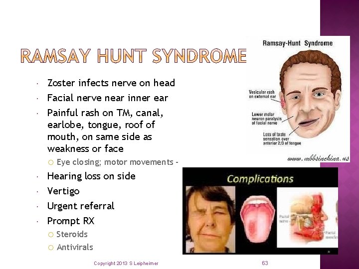  Zoster infects nerve on head Facial nerve near inner ear Painful rash on