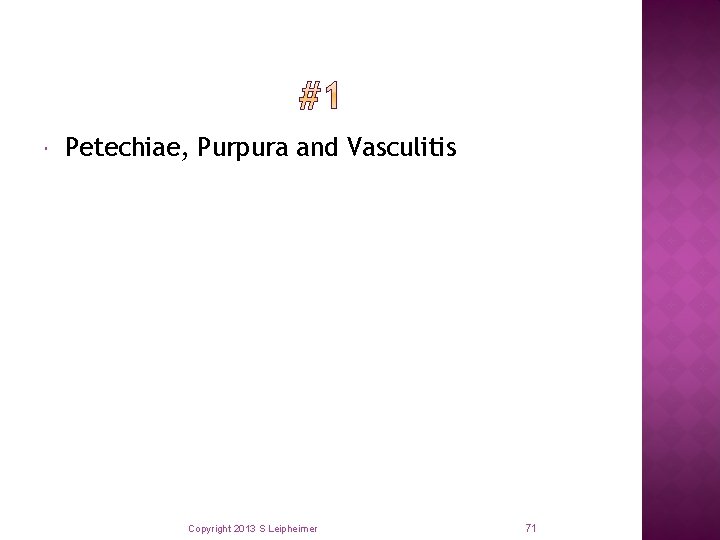 Petechiae, Purpura and Vasculitis Copyright 2013 S Leipheimer 71 
