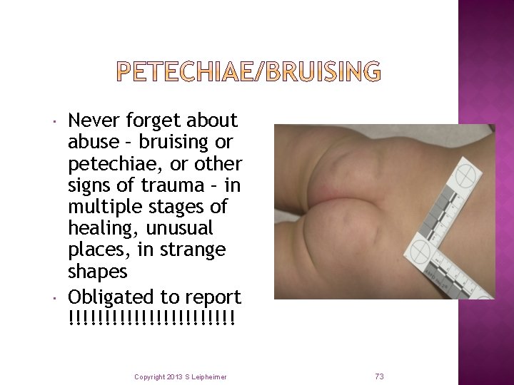  Never forget about abuse – bruising or petechiae, or other signs of trauma