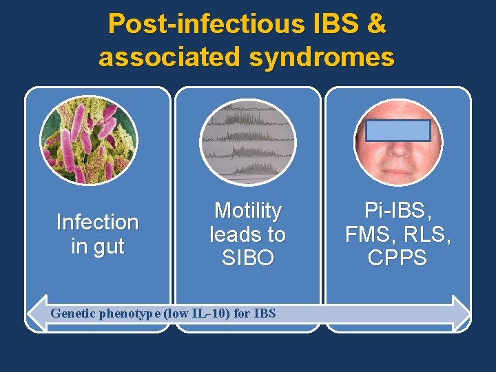 Post-infectious IBS & associated syndromes Infection in gut Motility leads to SIBO Genetic phenotype