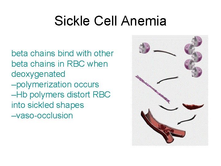 Sickle Cell Anemia beta chains bind with other beta chains in RBC when deoxygenated