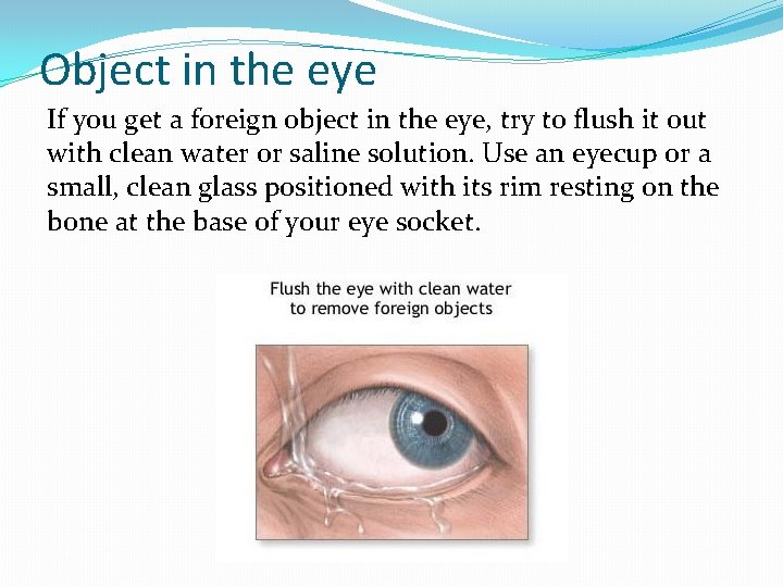 Object in the eye If you get a foreign object in the eye, try