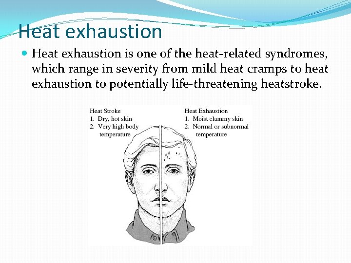 Heat exhaustion is one of the heat-related syndromes, which range in severity from mild