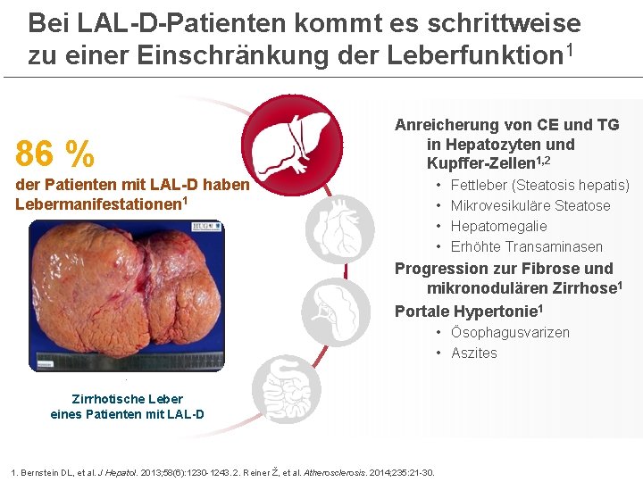 Bei LAL-D-Patienten kommt es schrittweise zu einer Einschränkung der Leberfunktion 1 Anreicherung von CE