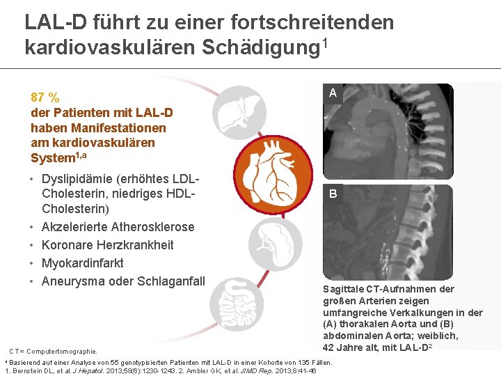 LAL-D führt zu einer fortschreitenden kardiovaskulären Schädigung 1 87 % der Patienten mit LAL-D