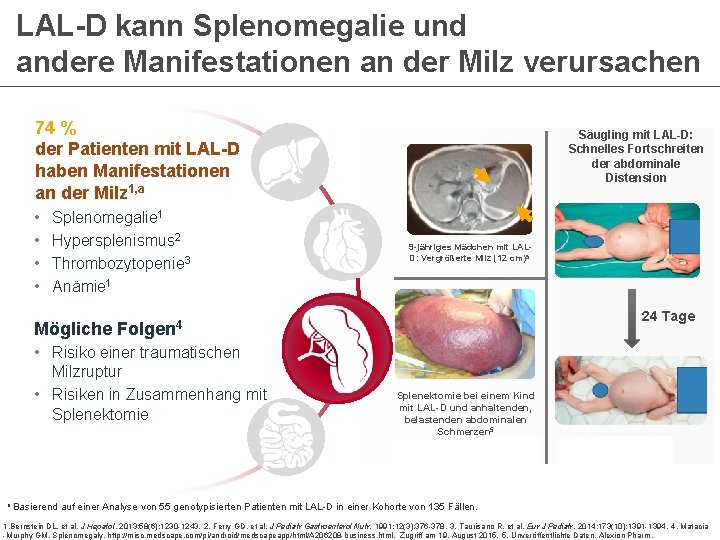 LAL-D kann Splenomegalie und andere Manifestationen an der Milz verursachen 74 % der Patienten